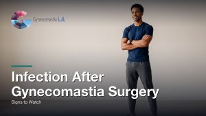 Infection After Gynecomastia Surgery: Signs to Watch, Gynecomastia Centers of Los Angeles