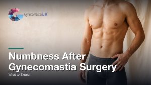 Numbness After Gynecomastia Surgery: What to Expect, Gynecomastia Centers of Los Angeles