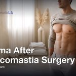 Seroma After Gynecomastia Surgery: Signs and Treatment, Gynecomastia Centers of Los Angeles