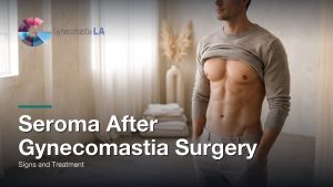 Seroma After Gynecomastia Surgery: Signs and Treatment, Gynecomastia Centers of Los Angeles