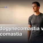 Pseudogynecomastia vs Gynecomastia: Is It Fat or Gland?, Gynecomastia Centers of Los Angeles