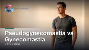 Pseudogynecomastia vs Gynecomastia: Is It Fat or Gland?, Gynecomastia Centers of Los Angeles